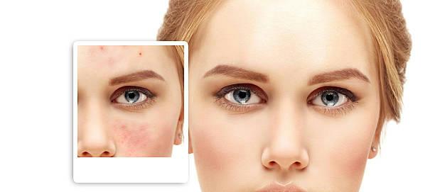 The signature of beauty is beautiful skin